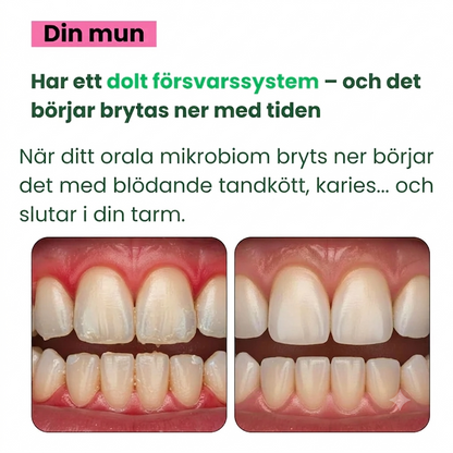 Munhygien & Mikrobiom - Kosttillskott för munflora och frisk andedräkt – probiotiskt kapseltillskott